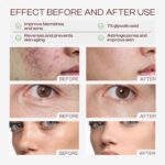 Glycolic Acid Toner: 240ml Glycolic Acid 7% Exfoliating Toner Toning Solution Which Soothes and Hydrates Skin - Image 3