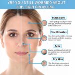 Niacinamide 10% + Zinc 1% Serum for Face – Oil Control, Acne, Pore Minimizer & Blemish Reduction – Lightweight, Non-Greasy Facial Serum, 30ml (1 Fl Oz) (1) - Image 4