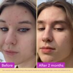 Good Molecules Niacinamide Serum - 10% Niacinamide to Target Blemishes, Nourishment, and Skin Tone - Ultra Hydrating Serum and Brightening Skin Care for Face - Image 3