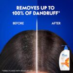 Head & Shoulders Anti Hair fall Shampoo, 2 Pack Anti Dandruff Shampoo, Relieves Dry Scalp and Repairs Damage, Fresh Scent, 22 oz Pump Bottles - Image 4