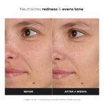 Paula's Choice SKIN BALANCING Pore-Reducing Face Toner with Niacinamide, for Oily Skin & Combination, Minimizes Large Pores, Controls Oil & Shine, Hydrates & Replenishes, Fragrance-Free - Image 3