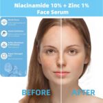 Niacinamide 10% + Zinc 1% Serum for Face – Oil Control, Acne, Pore Minimizer & Blemish Reduction – Lightweight, Non-Greasy Facial Serum, 30ml (1 Fl Oz) (1) - Image 2